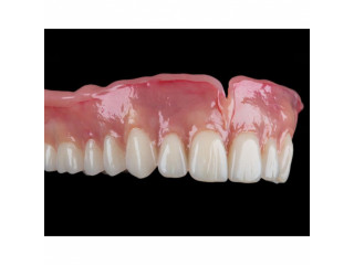 Complete denture for teeth replacement in Kampala near me