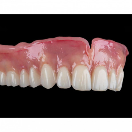 complete-denture-for-teeth-replacement-in-kampala-near-me-big-0