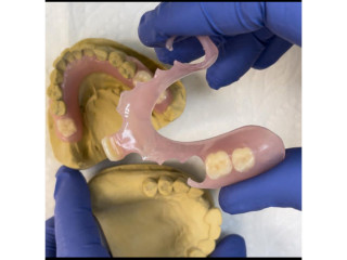 Flexible denture for teeth replacement in Kampala Uganda