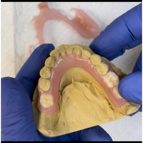 removable-denture-for-teeth-replacement-in-kampala-uganda-big-0