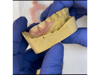 Partial denture for teeth replacement in Kampala near me