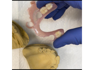 Flexible partial denture for teeth replacement in Kampala