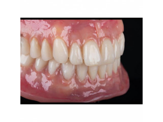 Complete denture for teeth replacement in Kampala near me in Uganda