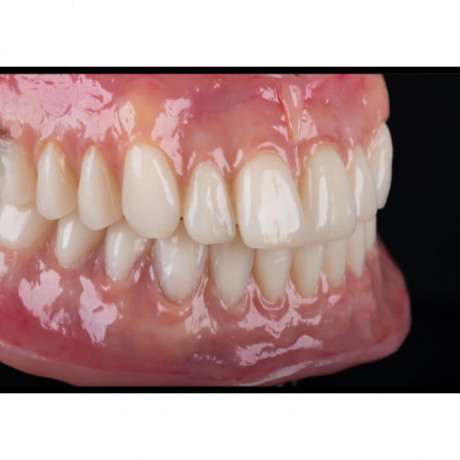 complete-denture-for-teeth-replacement-in-kampala-near-me-in-uganda-big-0