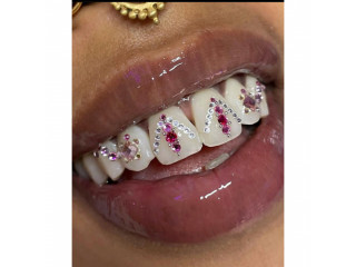 Teeth gem stones design in kampala near me