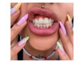 kampala-oral-gem-designs-for-teeth-in-kampala-small-0