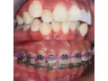 dental-clinic-around-wandegeya-small-0