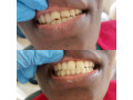 teeth-clinic-in-uganda-small-0