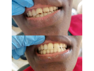 Teeth clinic in Uganda