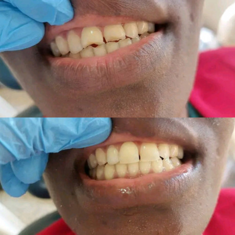 teeth-clinic-in-uganda-big-0