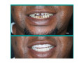 teeth-clinic-in-kampala-small-0