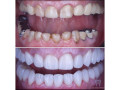 best-dental-clinic-in-uganda-small-0