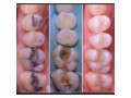 best-dental-clinic-in-mulago-small-0