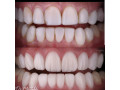best-dental-clinic-near-mulago-small-0