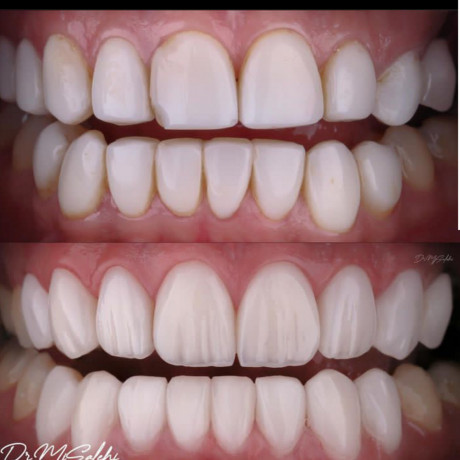 best-dental-clinic-near-mulago-big-0
