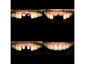 best-teeth-clinic-in-uganda-small-0