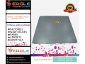 digital-body-weighing-platform-stainless-steel-scale-small-0