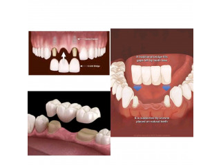 Dental solutions kampala