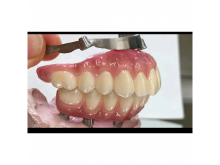 Complete denture for teeth replacement in Kampala