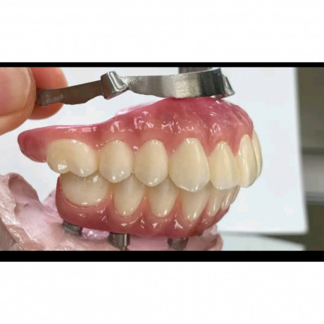 complete-denture-for-teeth-replacement-in-kampala-big-0