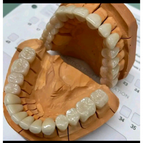 artificial-teeth-fabrication-in-kampala-big-0